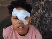 शिवपुरी की युवती पर राजस्थान के किन्नरों ने किया हमला, दिल्ली ले जाकर युवती को बनाना चाहते थे किन्नर