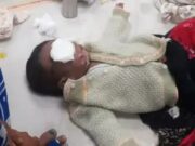 झाड़-फूंक में झुलसे 6 माह के बच्चे की मौत:परिजनों ने दफनाया शव, पुलिस निकलवा कर कराएगी पोस्टमार्टम; तांत्रिक गिरफ्तार