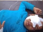 बस से झांक रहे बच्चे की आंख में लगी लकड़ी:परिजनों के साथ सरसों की कटाई के लिए दतिया जा रहा था