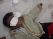 तांत्रिक की क्रूरता : छह माह के मासूम को आग पर लटकाया, आंखों की रोशनी गई, मामला दर्ज बच्चे की हालत गंभीर, शिवपुरी जिला अस्पताल में इलाज जारी